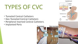 Presentation on Central line associated bloodstream infection | PPTX
