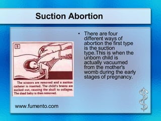 Suction Abortion There are four different ways of abortion the first type is the suction type.This is when the unborn child is actually vacuumed from the mother's womb during the early stages of pregnancy. www.fumento.com 