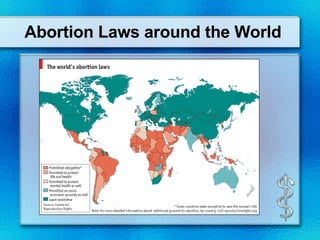 Abortion Laws around the World 