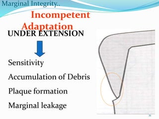 principles of tooth preparations | PPTX