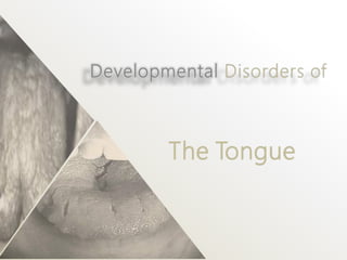 The Tongue
 