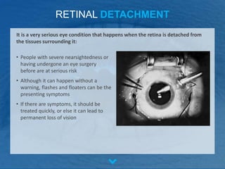 RETINAL DETACHMENT
• People with severe nearsightedness or
having undergone an eye surgery
before are at serious risk
• Although it can happen without a
warning, flashes and floaters can be the
presenting symptoms
• If there are symptoms, it should be
treated quickly, or else it can lead to
permanent loss of vision
It is a very serious eye condition that happens when the retina is detached from
the tissues surrounding it:
 
