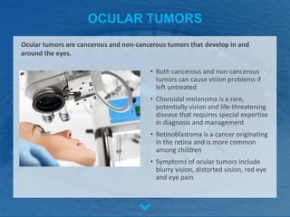 OCULAR TUMORS
• Both cancerous and non-cancerous
tumors can cause vision problems if
left untreated
• Choroidal melanoma is a rare,
potentially vision and life-threatening
disease that requires special expertise
in diagnosis and management
• Retinoblastoma is a cancer originating
in the retina and is more common
among children
• Symptoms of ocular tumors include
blurry vision, distorted vision, red eye
and eye pain
Ocular tumors are cancerous and non-cancerous tumors that develop in and
around the eyes.
 