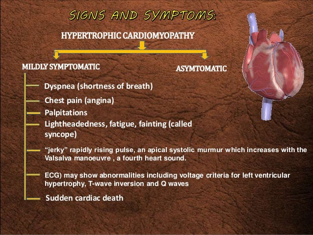 hypertrophic cardiomyopathy-a case report