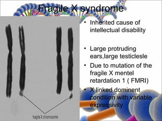 Fragile X syndrome
         • Inherited cause of
           intellectual disability

         • Large protruding
           ears,large testiclesle
         • Due to mutation of the
           fragile X mentel
           retardation 1 ( FMRI)
         • X linked dominent
           condition with variable
           expressivity
 