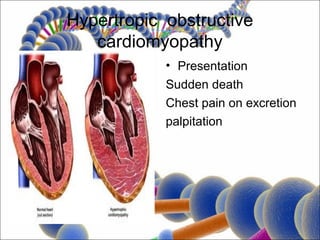 Hypertropic obstructive
   cardiomyopathy
            • Presentation
            Sudden death
            Chest pain on excretion
            palpitation
 