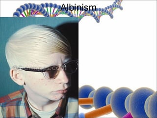 Albinism
 