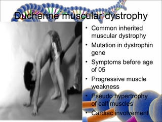 Duchenne muscular dystrophy
              • Common inherited
                muscular dystrophy
              • Mutation in dystrophin
                gene
              • Symptoms before age
                of 05
              • Progressive muscle
                weakness
              • Pseudo hypertrophy
                of calf muscles
              • Cardiac involvement
 
