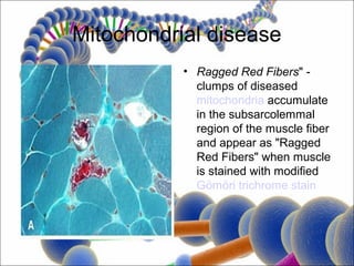 Mitochondrial disease
           • Ragged Red Fibers" -
             clumps of diseased
             mitochondria accumulate
             in the subsarcolemmal
             region of the muscle fiber
             and appear as "Ragged
             Red Fibers" when muscle
             is stained with modified
             Gömöri trichrome stain
 