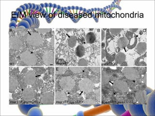 E/M view of diseased mitochondria
 