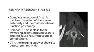 Removed First Rib Presentation (10)-4.pptx imaging in Thoracic outlet syndrome | PPTX