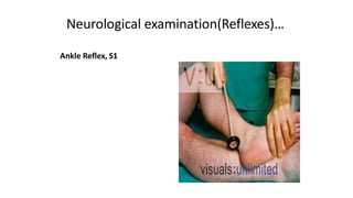 Neurological examination(Reflexes)…
Ankle Reflex, S1
 