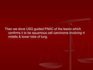Then we done USG guided FNAC of the lesion which confirms it to be squamous cell carcinoma involving rt middle & lower lobe of lung. 