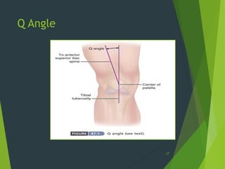 Q Angle
17
 