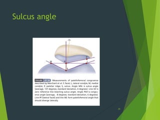 Sulcus angle
29
 