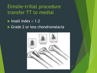 Elmslie-trillat procedure
transfer TT to medial
 Insall index  1.2
 Grade 2 or less chondromalacia
48
 