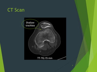 CT Scan
8
TT-TG:15 mm
Shallow
trochlea
 