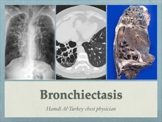 Bronchiectasis
HamdiAl-Turkey-chest physician
 