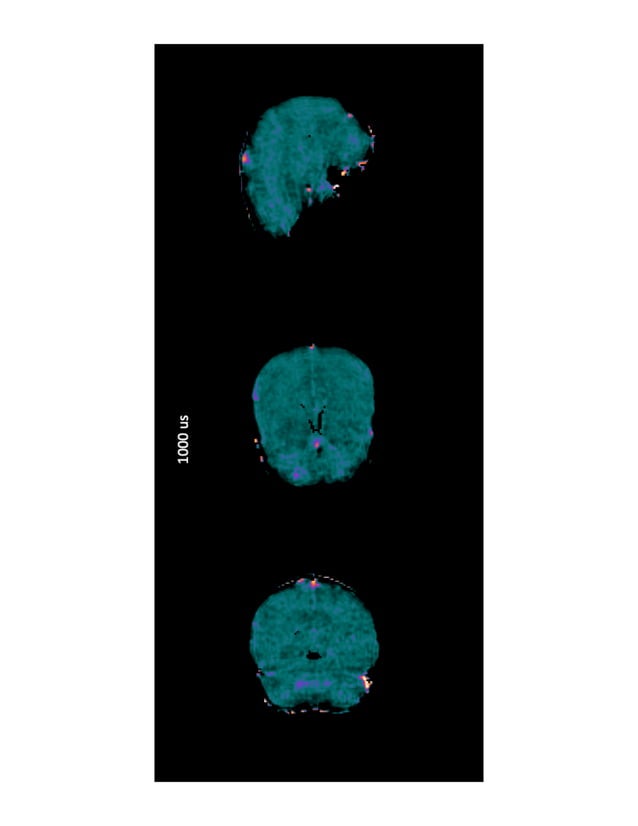 ultrashort echo time MRI for myelin imaging