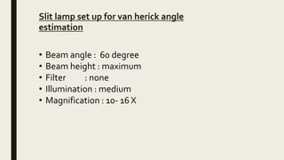 Slit lamp set up for van herick angle
estimation
• Beam angle : 60 degree
• Beam height : maximum
• Filter : none
• Illumination : medium
• Magnification : 10- 16 X
 