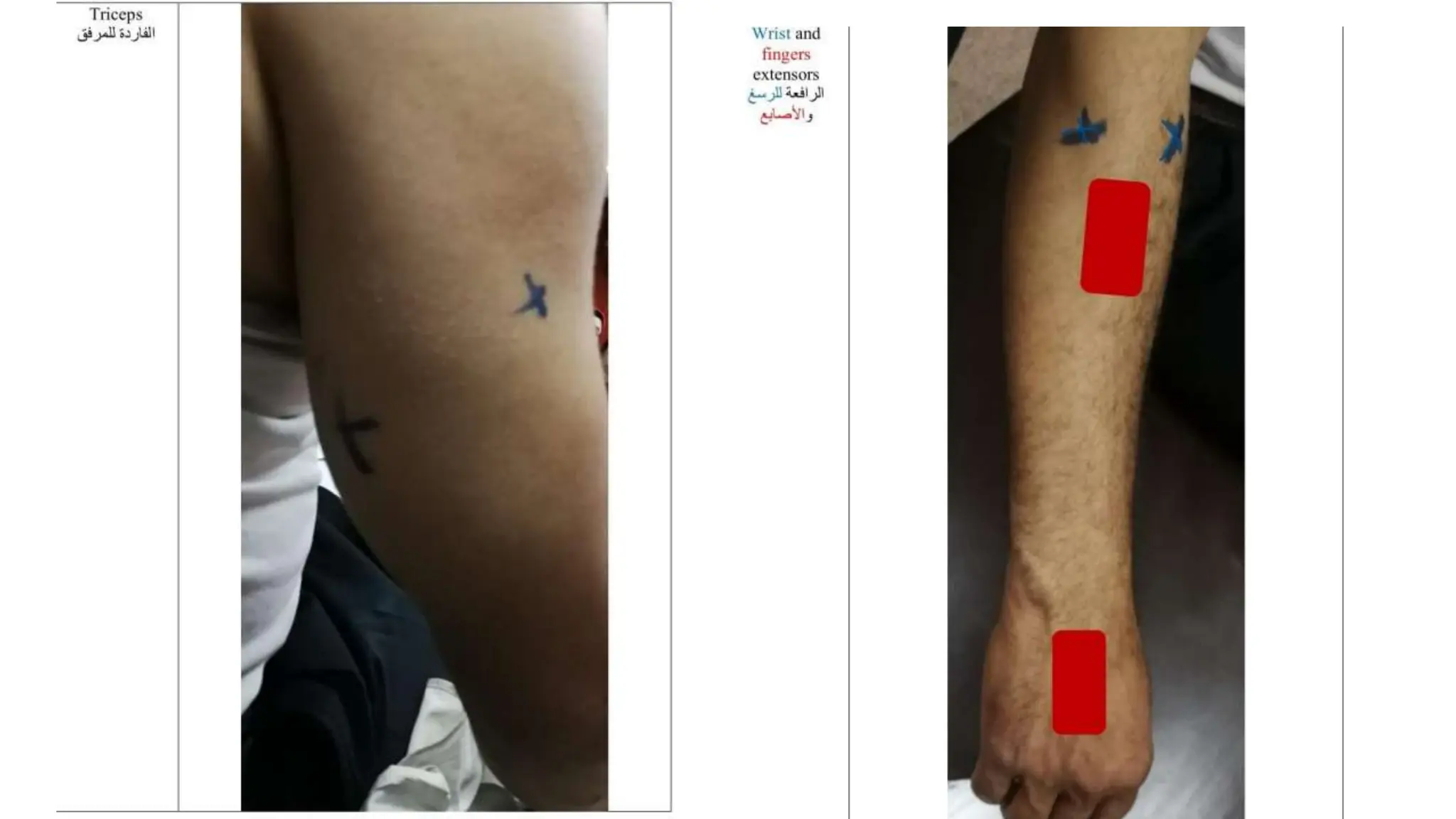 Presentation (1) (1).pptx electrotherapy