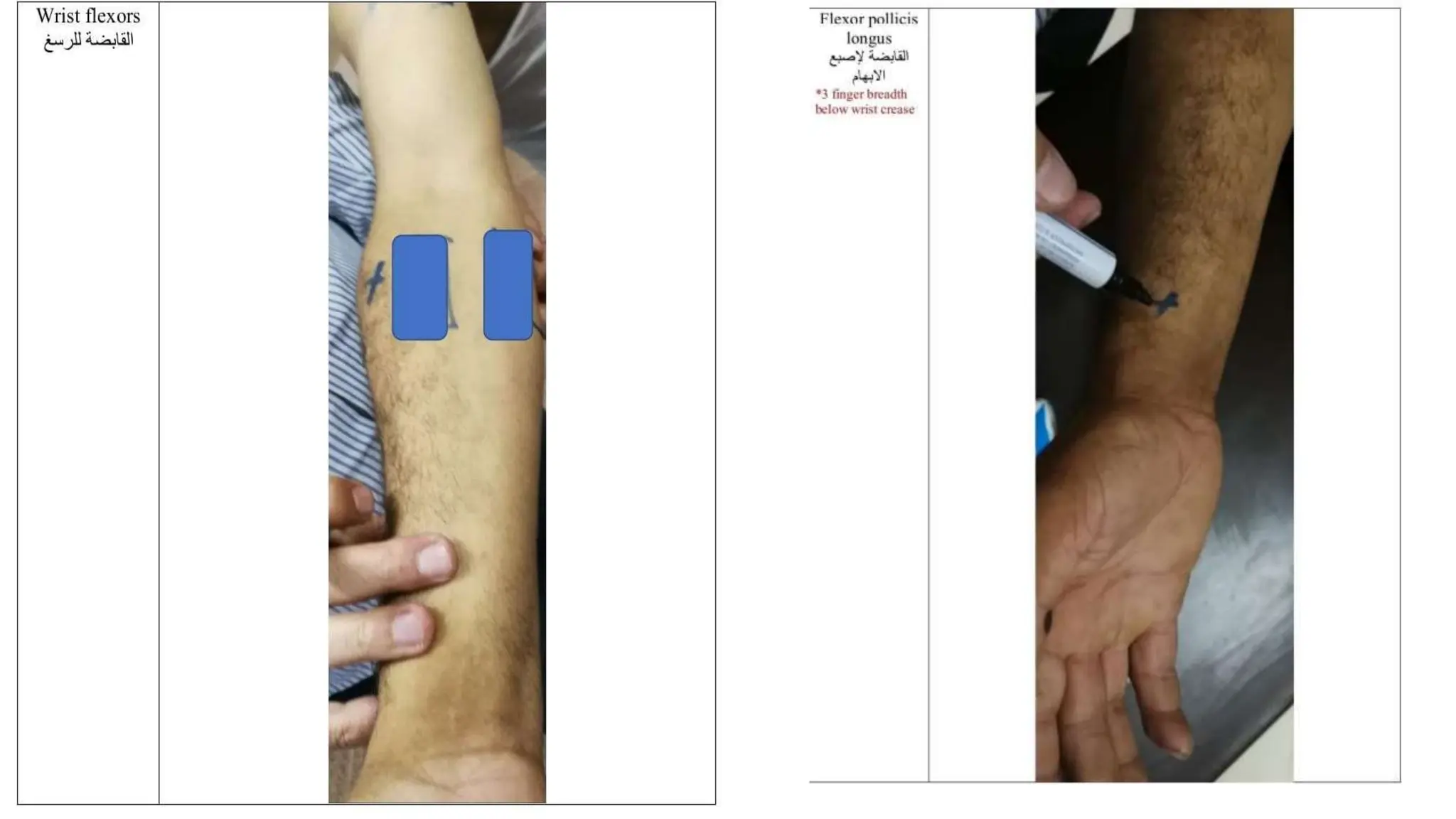 Presentation (1) (1).pptx electrotherapy