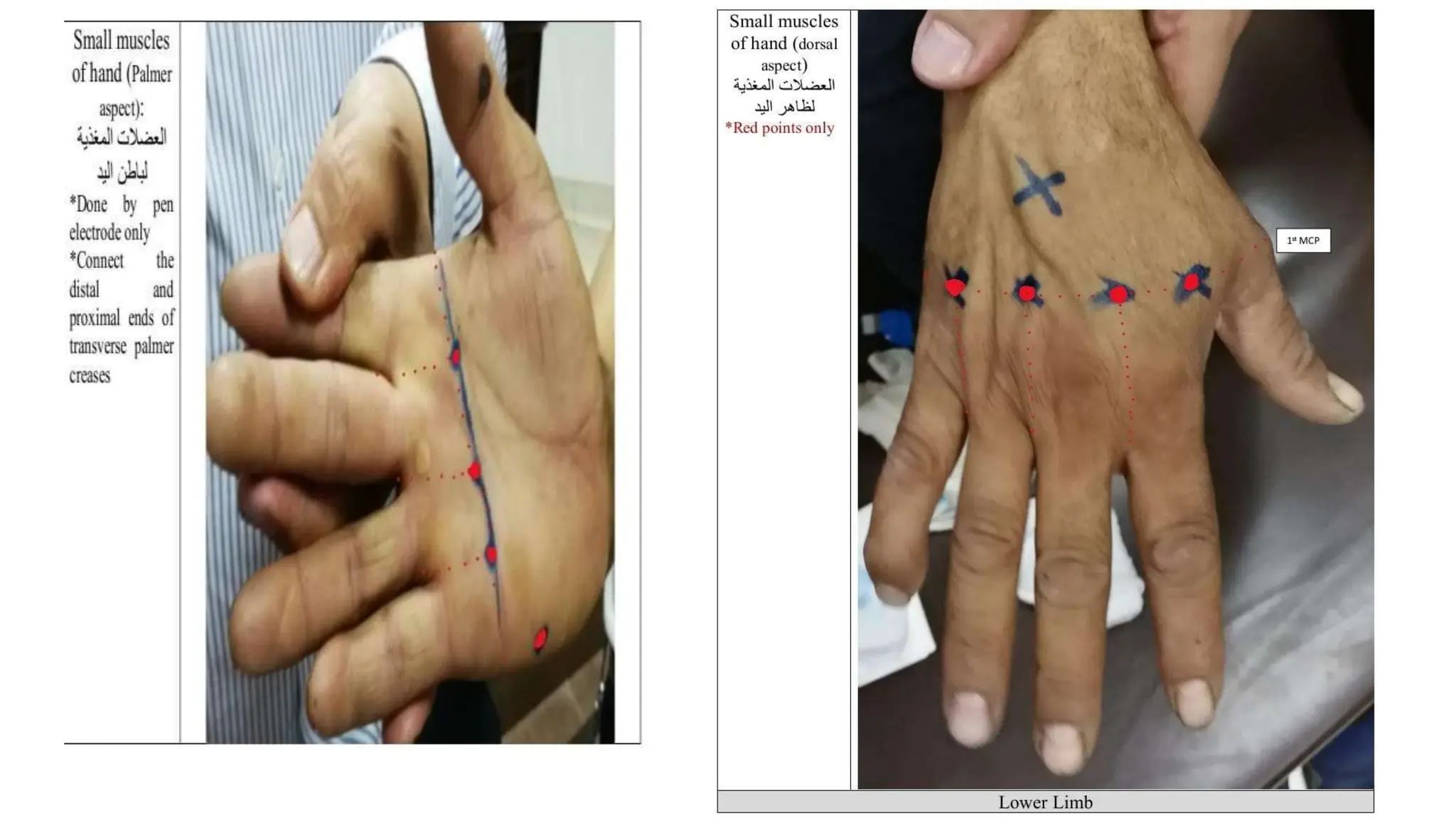 Presentation (1) (1).pptx electrotherapy