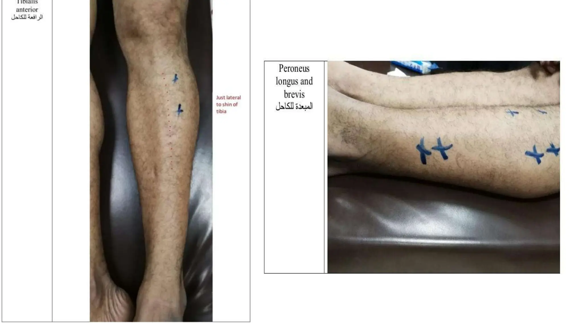 Presentation (1) (1).pptx electrotherapy