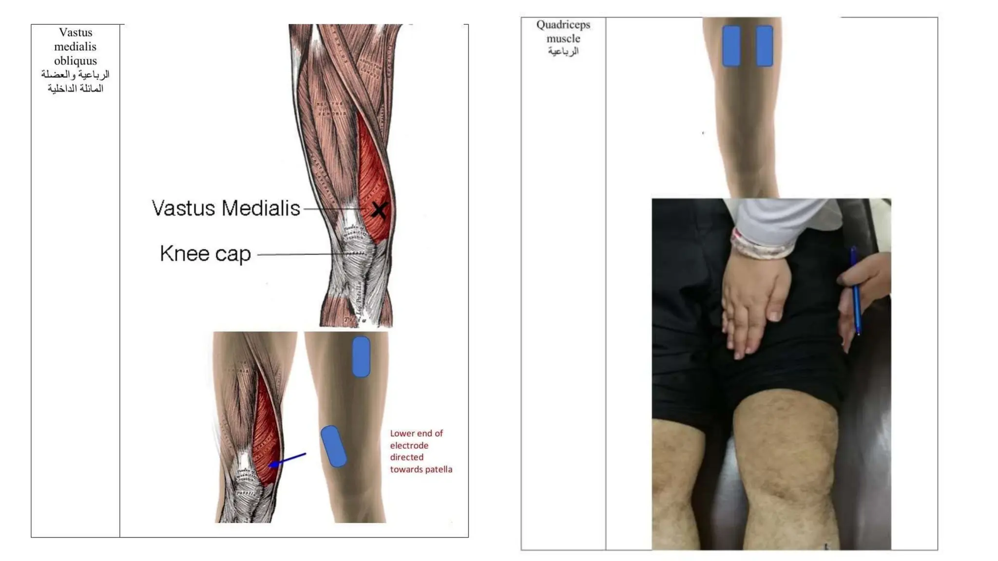 Presentation (1) (1).pptx electrotherapy