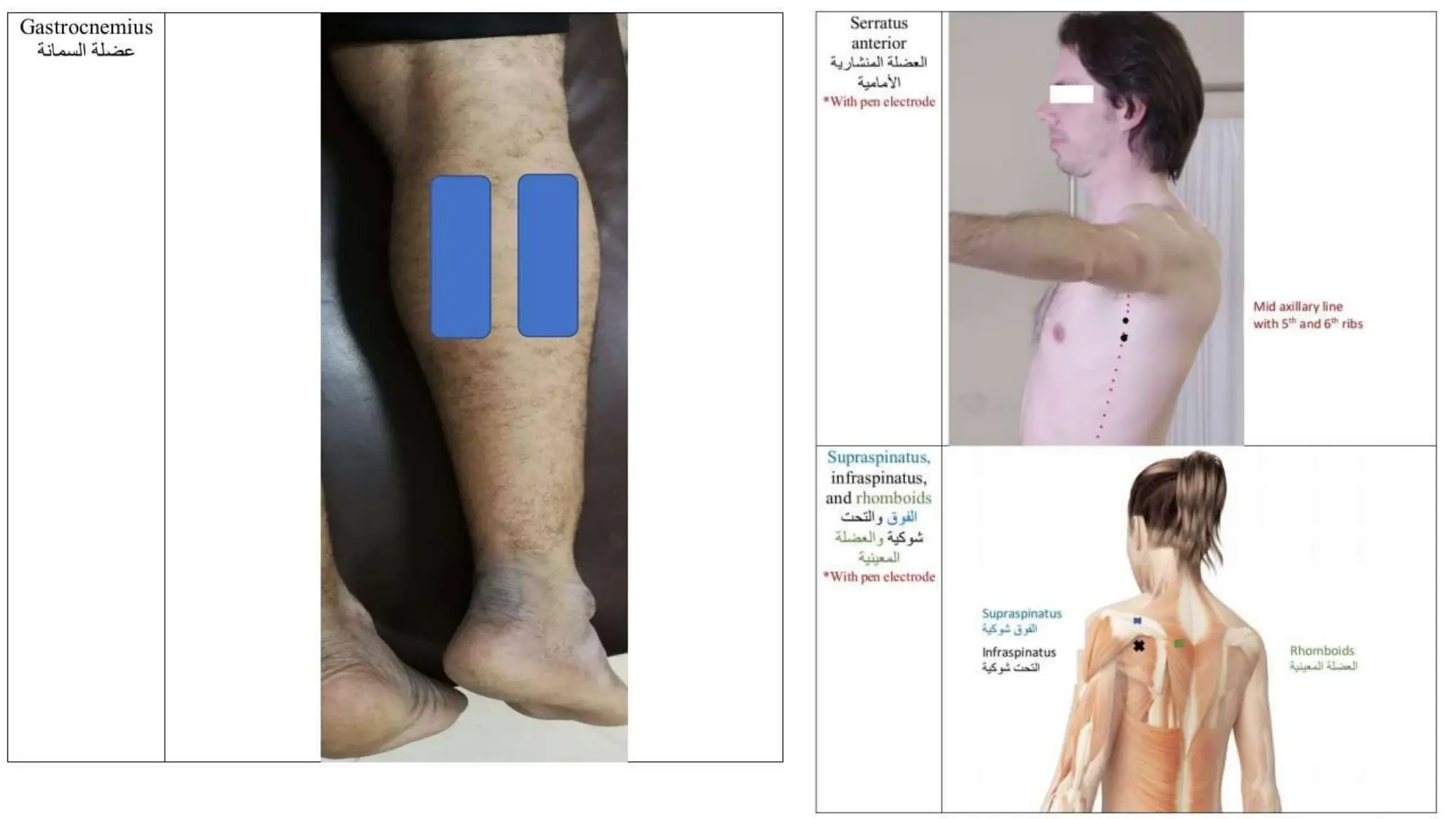 Presentation (1) (1).pptx electrotherapy