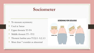 presentation on spinal defects and deformities | PDF