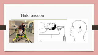 presentation on spinal defects and deformities | PDF