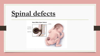 presentation on spinal defects and deformities | PDF