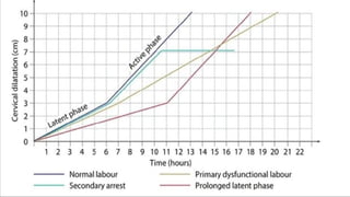 Mechanism of labour plus abnormalities in labour | PPTX