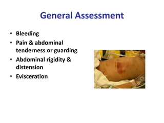 Abdominal-injuries-in-sports.pptx