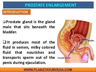 PROSTATE ENLARGEMENT
 Prostate gland is the gland
male that sits beneath the
bladder.
 It produces most of the
fluid in semen, milky colored
fluid that nourishes and
transports sperm out of the
penis during ejaculation.
INTRODUCTION
 