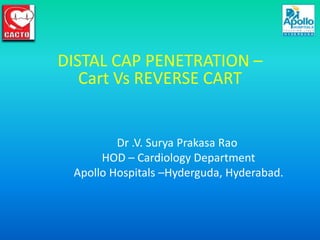 DISTAL CAP PENETRATION –
   Cart Vs REVERSE CART


         Dr .V. Surya Prakasa Rao
      HOD – Cardiology Department
 Apollo Hospitals –Hyderguda, Hyderabad.
 