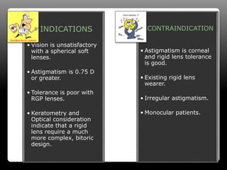 Soft Toric Contact Lens | PPTX