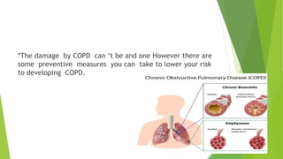 COPD | PPTX