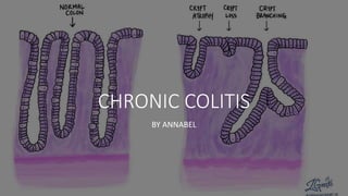 CHRONIC COLITIS
BY ANNABEL
 