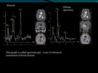 BASICS OF MRI | PPT