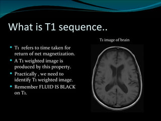 T1 Function BASICS OF MRI | PPT