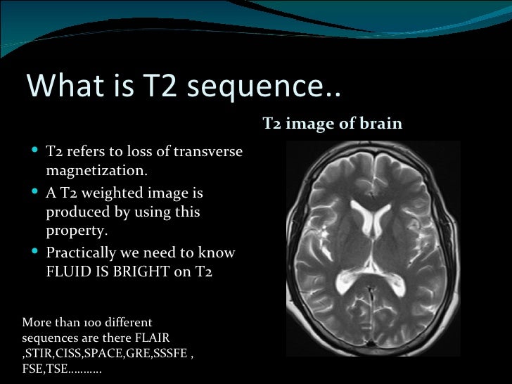 basics of mri how to read brain mri