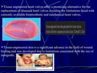 Tissue engineered heart valves offer a promising alternative for the
replacement of diseased heart valves avoiding the limitations faced with
currently available bioprosthetic and mechanical heart valves.
Tissue-engineered skin is a significant advance in the field of wound
healing and was developed due to limitations associated with the use of
autografts.
 