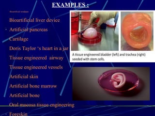 Bioartificial windpipe
Bioartificial liver device
· Artificial pancreas
Cartilage
Doris Taylor ‘s heart in a jar
Tissue engineered airway
Tissue engineered vessels
Artificial skin
Artificial bone marrow
Artificial bone
Oral mucosa tissue engineering
· Foreskin
EXAMPLES :
 