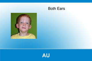 Is a process by which sound waves are transmitted to the inner ear by the cranial bones without traveling through the air in the ear canal 