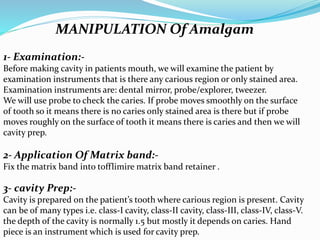 MANIPULATION Of Amalgam
1- Examination:-
Before making cavity in patients mouth, we will examine the patient by
examination instruments that is there any carious region or only stained area.
Examination instruments are: dental mirror, probe/explorer, tweezer.
We will use probe to check the caries. If probe moves smoothly on the surface
of tooth so it means there is no caries only stained area is there but if probe
moves roughly on the surface of tooth it means there is caries and then we will
cavity prep.
2- Application Of Matrix band:-
Fix the matrix band into tofflimire matrix band retainer .
3- cavity Prep:-
Cavity is prepared on the patient’s tooth where carious region is present. Cavity
can be of many types i.e. class-I cavity, class-II cavity, class-III, class-IV, class-V.
the depth of the cavity is normally 1.5 but mostly it depends on caries. Hand
piece is an instrument which is used for cavity prep.
 