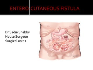 ENTERO-CUTANEOUS FISTULA
Dr Sadia Shabbir
House Surgeon
Surgical unit 1
 