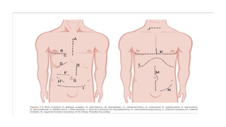 Approximated Incision Healing Ridge Comprehensive Guide to Surgical Exposure and Wound Approximation ...