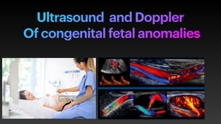 Ultrasound and Doppler


Of congenital fetal anomalies
 